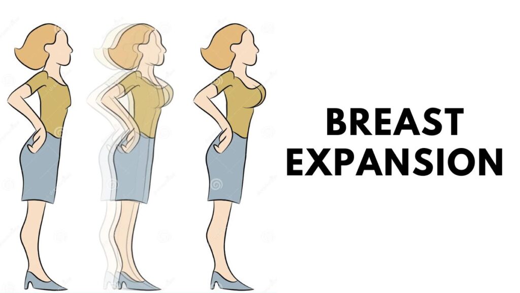 Breast Expansion